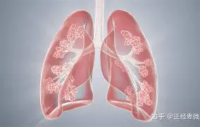 ZJ?rA8u?￡槲跁蚇V/*墜?A的简单介绍